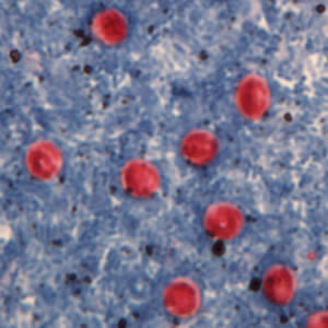 Cryptosporidium sp. oocysts stained with Ziehl-Neelson modified acid-fast. Image contributed by the Oregon State Public Health Laboratory. Adapted from CDC