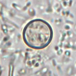 Oocyst of C. cayetanensis in an unstained wet mount. Image courtesy of the Oregon State Public Health Laboratory. Adapted from CDC