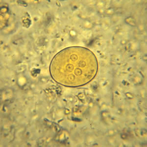 Cyst of E. coli in a concentrated wet mount stained with iodine. Five nuclei are visible in this focal plane