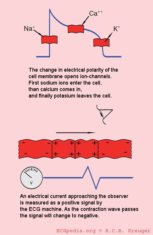 During the depolarization sodium-ions stream inwards the cell. Subsequently the calcium-ions stream into the cell. These calcium-ions give the actual muscular contraction. Finally the potassium-ions stream out of the cell. During the repolarisation the ion concentration is corrected. On the ECG, an action potential wave coming towards the electrode is shown as a positive (upwards) signal. Here the ECG electrode is represented as an eye.