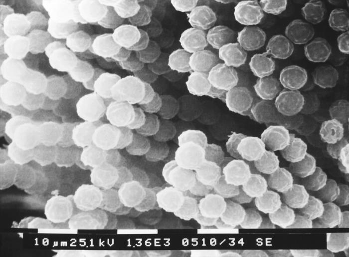 This scanning electron micrograph (SEM) depicts numbers of chains of Aspergillus specie fungal conidiospores. From Public Health Image Library (PHIL). [2]