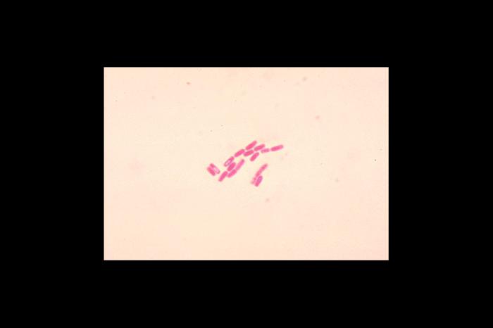 Bacillus cereus. Gram stain. From Public Health Image Library (PHIL). [22]