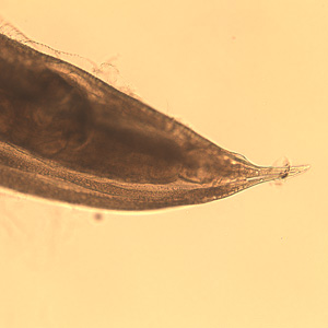 Posterior end of a female Oesophagostomum sp., showing the pointed tail. Adapted from CDC