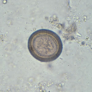 Taenia sp. egg in unstained wet mounts. Adapted from CDC