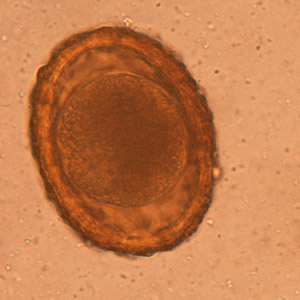 Unembryonated egg of B. procyonis. Adapted from CDC