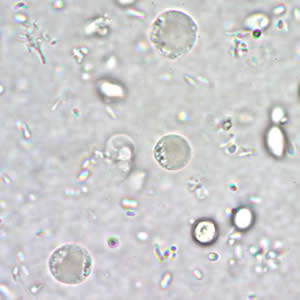 B. hominis cyst-like forms in a wet mount, unstained. Adapted from CDC