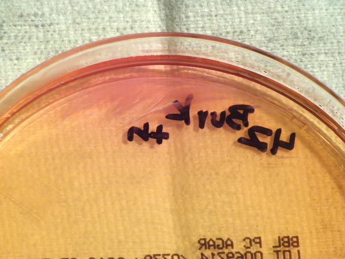 Gram-negative Burkholderia thailandensis bacteria, which was grown on a medium of Pseudomonas cepacia (PC) agar 24hrs. From Public Health Image Library (PHIL). [5]