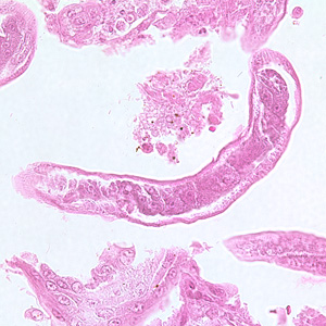 Longitudinal section of an adult of C. philippinensis from an intestinal biopsy specimen stained with hematoxylin and eosin (H&E). Adapted from CDC