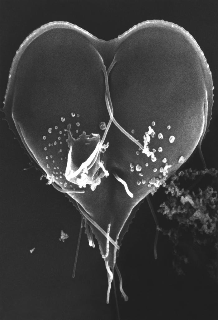 SEM depicts a Giardia lamblia protozoan in a late stage of cell division that was about to become two separate organisms, producing a heart-shaped form. From Public Health Image Library (PHIL). [2]
