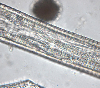Mid-section of a gravid female Thelazia sp., showing many typical spirurid-type eggs. Adapted from CDC
