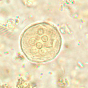 Cyst of E. coli in a unstained concentrated wet mount. Six nuclei are visible in this focal plane. Adapted from CDC