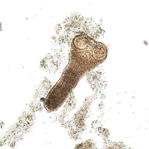 Scolex of H. nana in an unstained wet mount of stool. Image courtesy of Dr. David Bruckner. Adapted from CDC