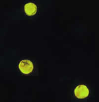 Cryptosporidium parvum oocysts stained with the fluorescent stain auramine-rhodamine. Adapted from CDC