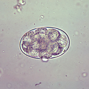Egg of Oesophagostomum sp.in an unstained wet mount of stool.