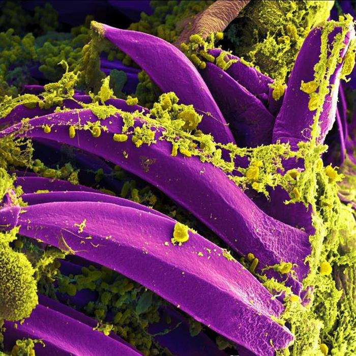 Purple-colored Yersinia pestis bacteria on the proventricular spines of a Xenopsylla cheopis flea. From Public Health Image Library (PHIL). [18]