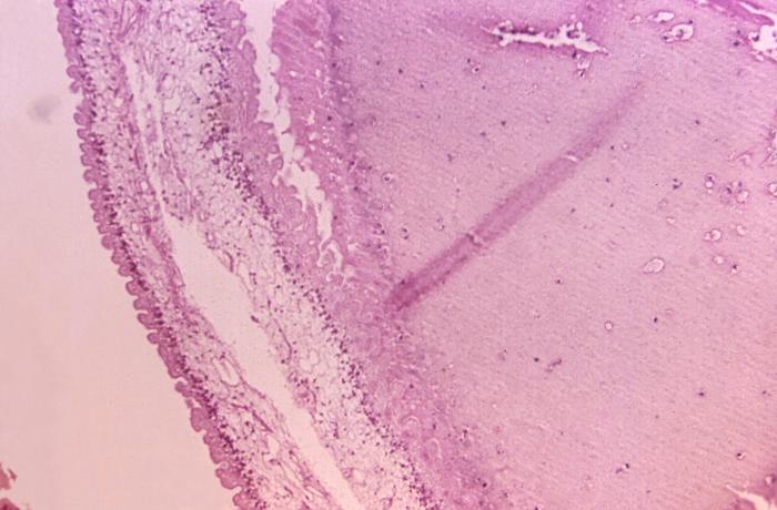 Image reveals the presence of numbers of pork tapeworm, Taenia solium cysticerci, which had contaminated this sample of porcine muscle tissue. From Public Health Image Library (PHIL). [4]