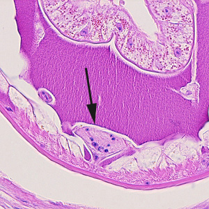 Close-up of Figure 1, showing the ventral chord (black-arrow). Adapted from CDC