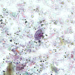 Cyst of R. intestinalis in a stool specimen, stained with trichrome. Adapted from CDC