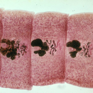 Carmine-stained proglottids of D. latum, showing the rosette-shaped ovaries. Source: https://www.cdc.gov/dpdx/diphyllobothriasis/index.html