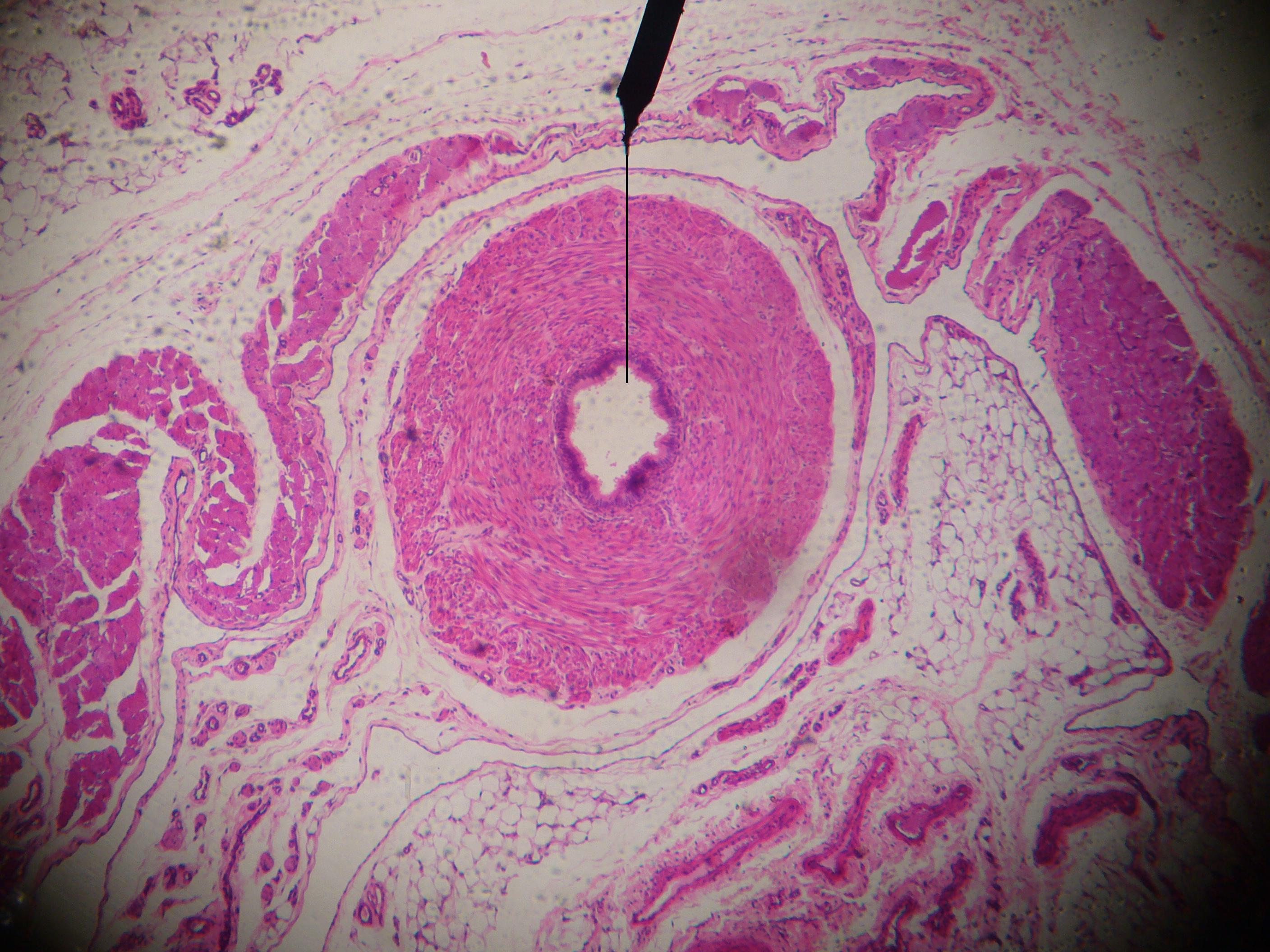 Microscopic cross section.