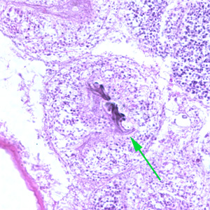 Higher magnification (400x) of the specimen in Figure 3. Notice the refractile hook (green arrow). Adapted from CDC