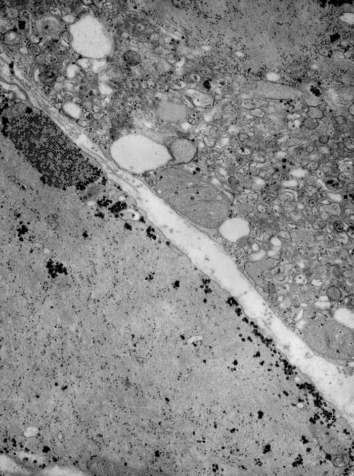 Transmission electron micrograph (TEM) reveals the presence of coxsackie B3 virus particles, found within a specimen of muscle tissue. From Public Health Image Library (PHIL). [27]