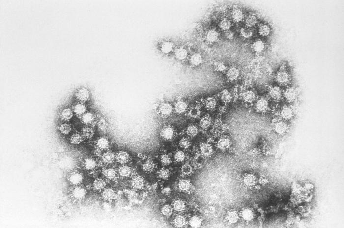 Immunoelectron microscopic technique able to discern the morphologic traits of the Coxsackie B4 virus virions. From Public Health Image Library (PHIL). [27]