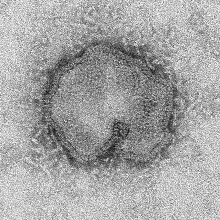 This negatively-stained transmission electron micrograph (TEM) captured some of the ultrastructural details exhibited by the new influenza A (H7N9) virus. Image obtained from Public Health Image Library (PHIL).