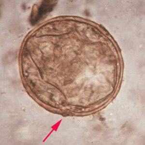 Egg of S. japonicum in an unstained wet mount. Note the small, inconspicuous spines (red arrows). Adapted from CDC