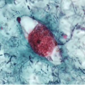 Immature oocyst of C. belli stained with safranin, containing a single sporoblast. Adapted from CDC