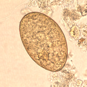 Egg of F. buski in unstained wet mounts. Adapted from CDC