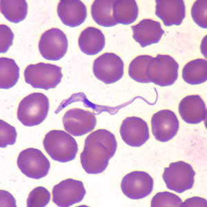 Trypanosoma brucei ssp. in a thin blood smear stained with Wright-Giemsa. Adapted from CDC