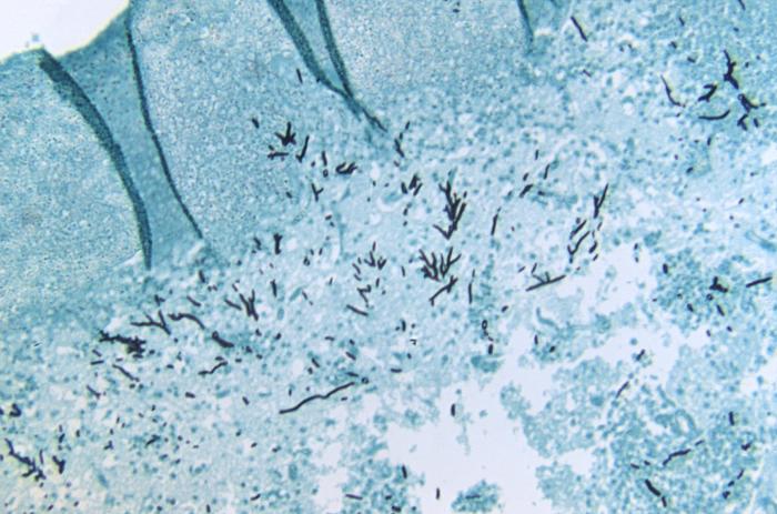 This photomicrograph revealed the presence of Aspergillus fumigatus fungal organisms in a brain tissue, methenamine silver-stained specimen harvested from a turkey poult that had contracted this infection. From Public Health Image Library (PHIL). [2]