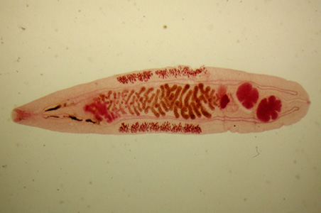 Adult of O. felineus. Image courtesy of the Web Atlas of Medical Parasitology and the Korean Society for Parasitology. Adapted from CDC