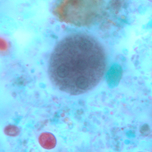 Mature cyst of E. coli, stained with trichrome. Five nuclei are visible in this focal plane. Adapted from CDC