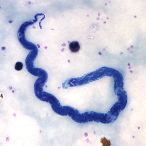 Microfilaria of L. loa in a thick blood smear, stained with Giemsa. Adapted from CDC