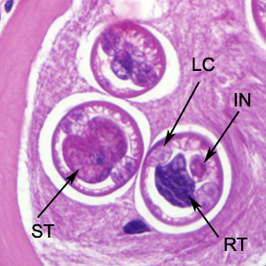 Higher-magnification of the larvae in Figure 3. Shown in these cuts are a nucleated stichocyte (ST), prominent lateral chords, or bacillary bands, (LC), immature reproductive tubes (RT), and the intestine (IN). Image captured at 1000x magnification. Adapted from CDC
