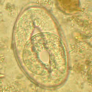 Egg of a trichostrongyle from the same specimen as Figures 1 and 2. In this egg, a developing larva can be observed. Adapted from CDC