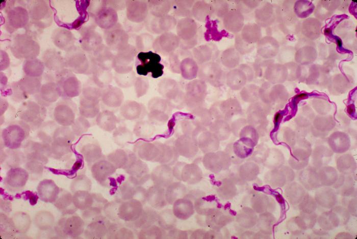 File:African trypanosomiasis05.jpeg