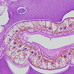 Higher-magnification of the specimens shown in Figures 1 and 2, showing a close-up of the characteristic intestine, with cuboidal, uninucleate cells, pigment, and microvilli. Adapted from CDC