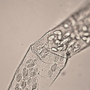 Mid-section of a female Thelazia sp. Note the prominent striations. Adapted from CDC