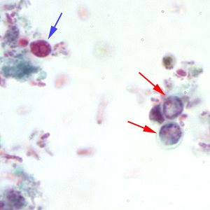 Cryptosporidium sp. oocysts stained with trichrome. Oocysts may be detected, but should not be confirmed by this method. Trichrome staining is inadequate for a definite diagnosis because oocysts will appear unstained. Here the Cryptosporidium oocysts are represented by red arrows; the blue arrow represents yeast. Adapted from CDC