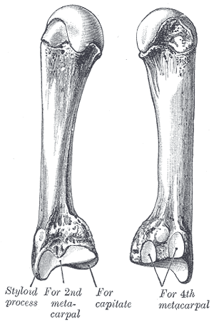 Third metacarpal bone