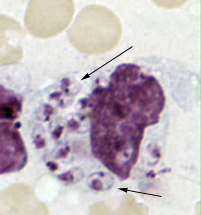 Leishmania tropica amastigotes from an impression smear of a biopsy specimen from a skin lesion. In this figure, an intact macrophage is practically filled with amastigotes (arrows), several of which have a clearly visible nucleus and kinetoplast. Adapted from CDC