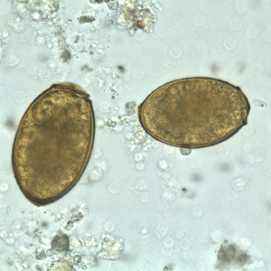 Eggs of P. westermani in an unstained wet mount. Adapted from CDC
