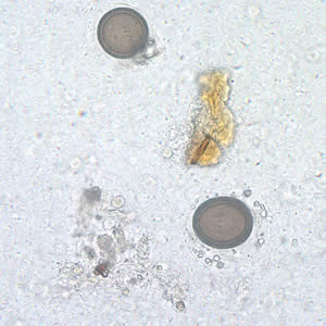 Unstained Taenia sp. egg, teased from a proglottid of an adult. Four hooks can easily be seen in this image. Adapted from CDC