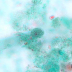 Cyst of C. mesnili in a stool specimen, stained with trichrome. Image taken at 1000x magnification. Adapted from CDC
