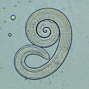 Larva of Trichinella liberated from bear meat. This larva is from a different case than those shown in Figures 1-4. Adapted from CDC