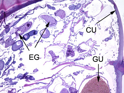 Cross-sections of T. penetrans in tissue, stained with hematoxylin and eosin (H&E). In this image, the following structures are labeled: cuticle (CU), gut (GU), and developing eggs (EG). Adapted from CDC