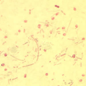 Enterocytozoon bieneusi spores stained with Chromotrope 2R. Adapted from CDC